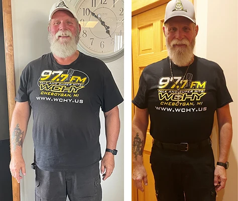 Weight Loss Battle Creek MI Trucker Randy Transformation Front